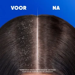 Head & Shoulders Anti-Haaruitval Antiroosshampoo